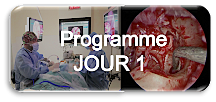 Bouton 20programme 20jour 202