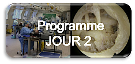 Bouton 20programme 20jour 202png